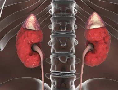 Νεφρική ανεπάρκεια: Αυτά είναι τα επικίνδυνα σημάδια!